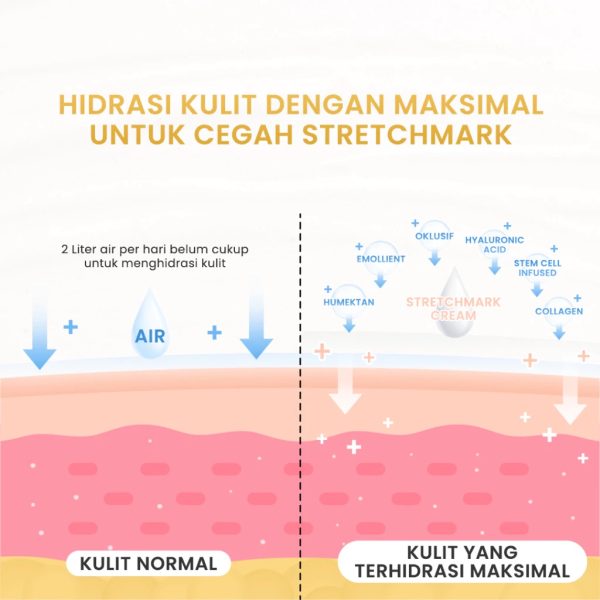 Stretchmark Cream