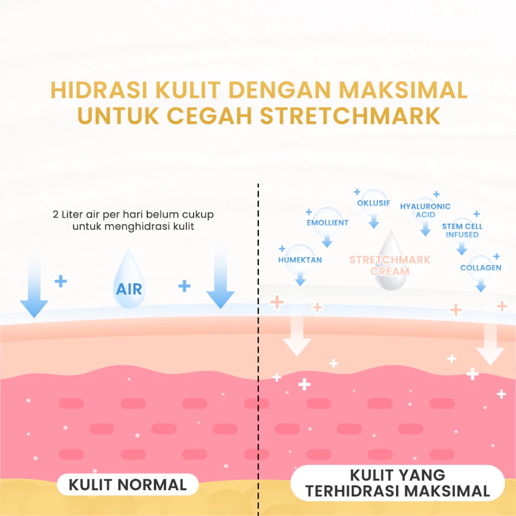 Stretchmark Cream