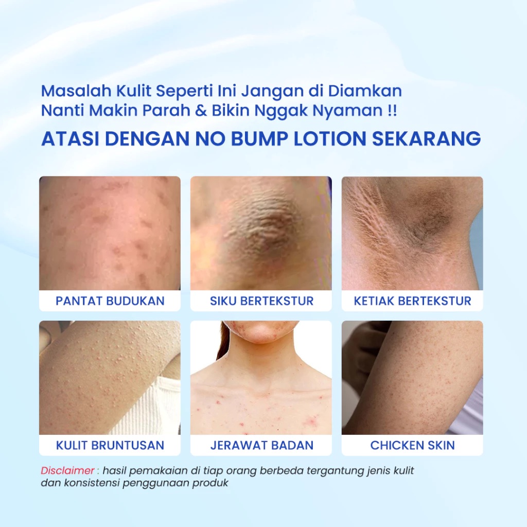 No Bump Lotion - Image 3